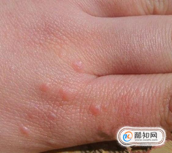 电脑软件打开变大怎么恢复_win7电脑所有软件都打不开_电脑软件打开后闪退怎么回事