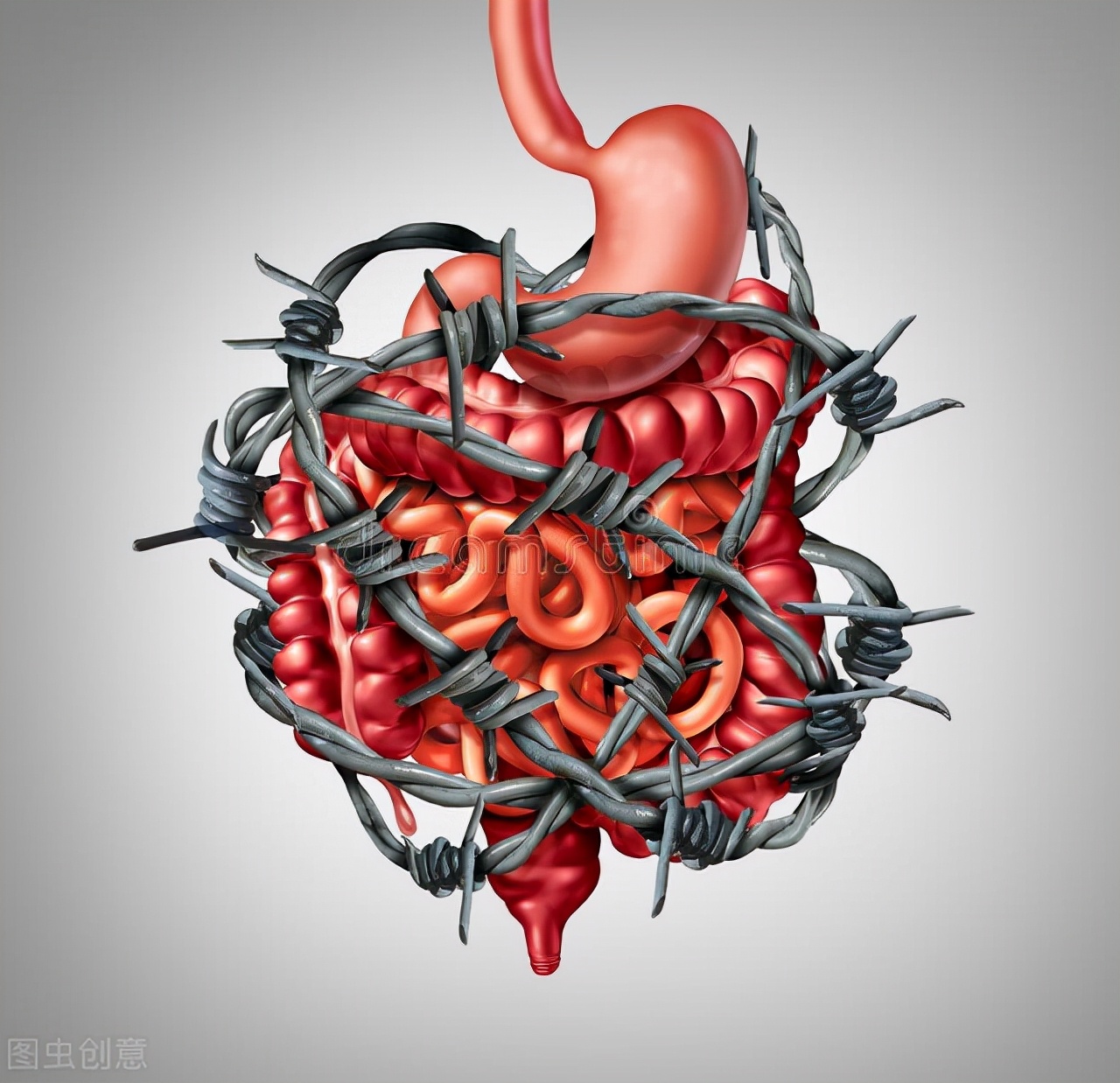 克罗恩病护理重点_克罗恩病并发症的护理_克罗恩护理诊断