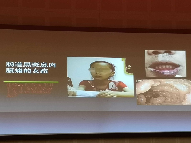 罗克恩病早期症状_克罗恩不治疗会怎样_罗克恩病能治好吗
