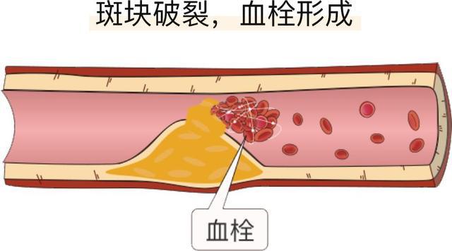 钱包被盗时的心情描写_钱包被盗怎么办_imtoken钱包被盗