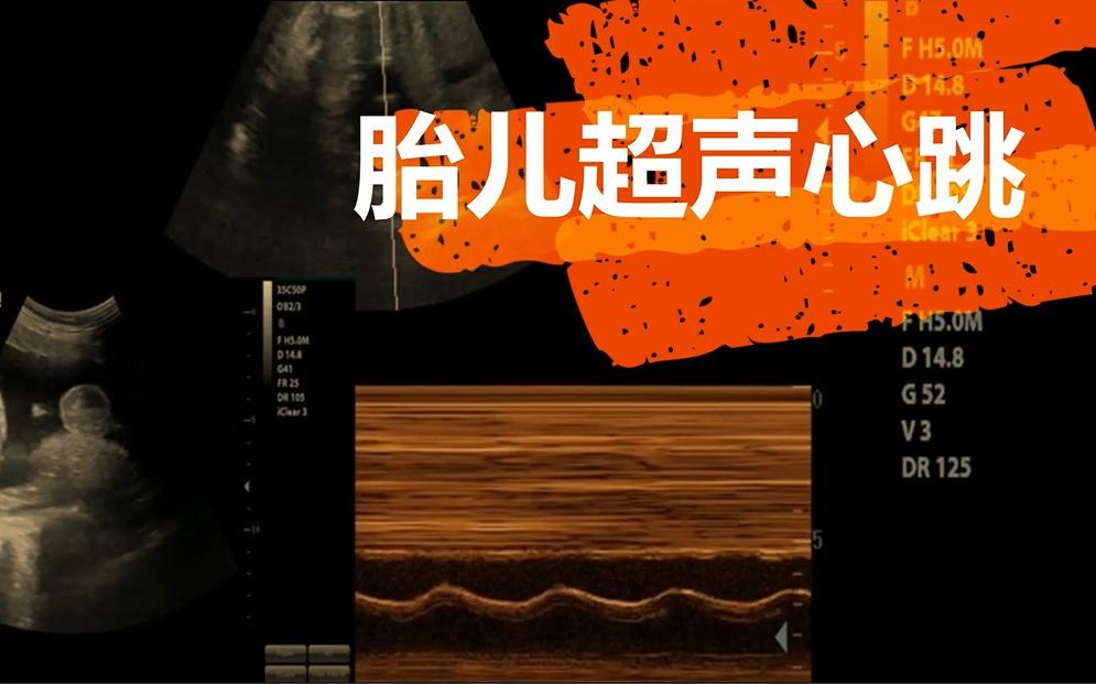 firstbpm_firstbpm_firstbpm