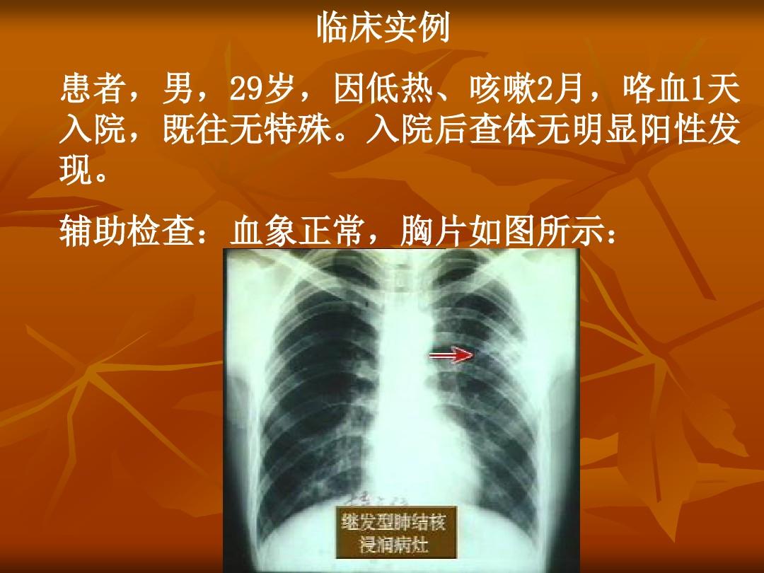 三型肺结核可以自愈吗_肺结核自愈还需要治疗吗_肺结核自愈期间会传染吗