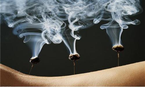 胃病艾灸患者经验交流_胃病的艾灸疗法_患者胃病经验交流艾灸治疗方案