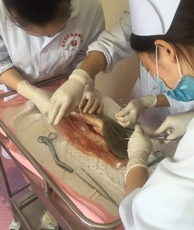 试述急性阑尾炎术后护理要点_急性阑尾炎的术后护理错误的是_急性阑尾炎术后护理习题