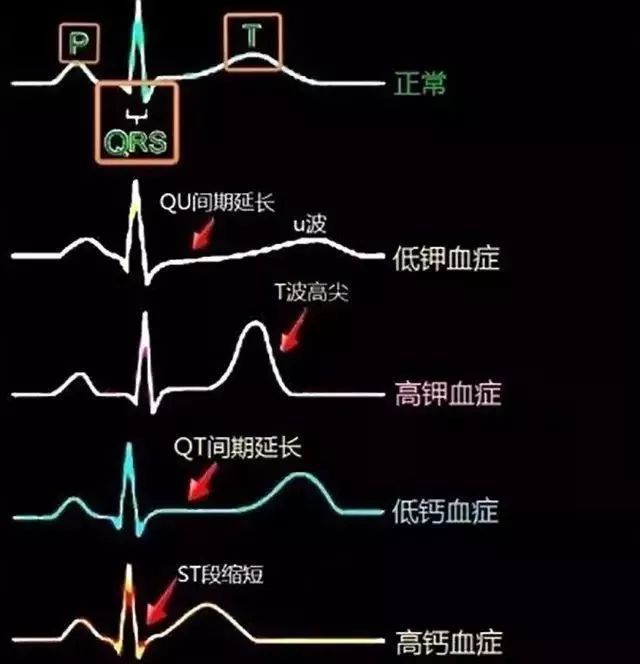 冠心病的常规护理_冠心病疾病护理常规_冠心病一般护理常规最新版本