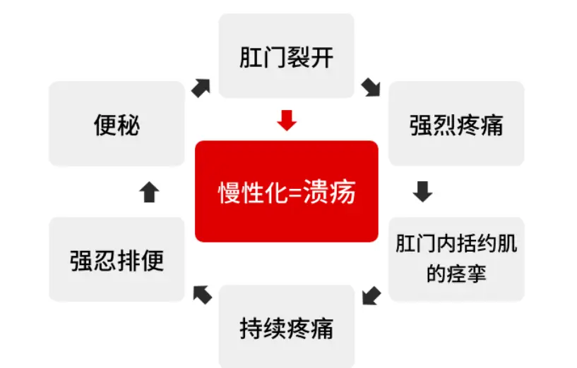 什么叫肛门失禁_肛门失禁的临床表现_肛门失禁的症状及治疗