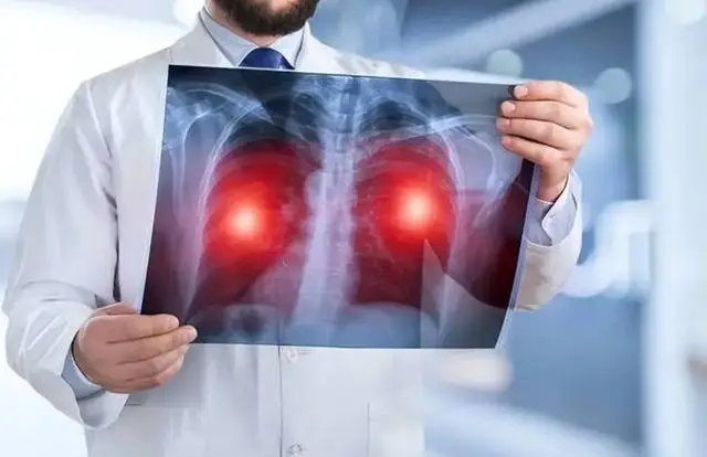 肺白是什么病_白肺症状_白肺临床表现