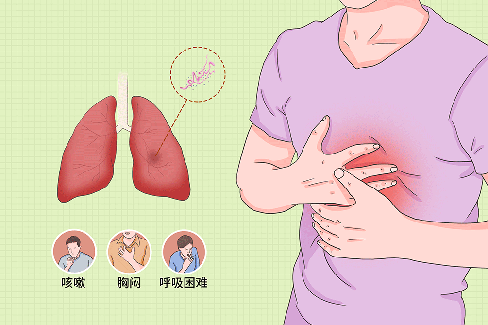 心肺病症状_心肺疾病症状_心肺病的主要症状