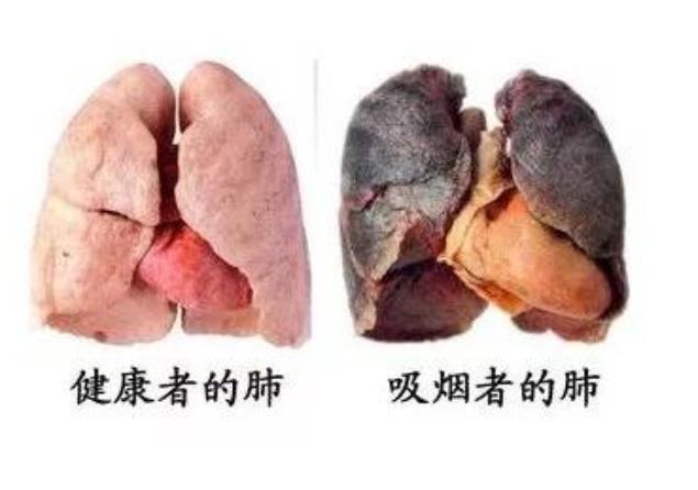 肺细胞角蛋白21-1偏高原因_肺细胞角蛋白高8点多危险吗_肺细胞角蛋白