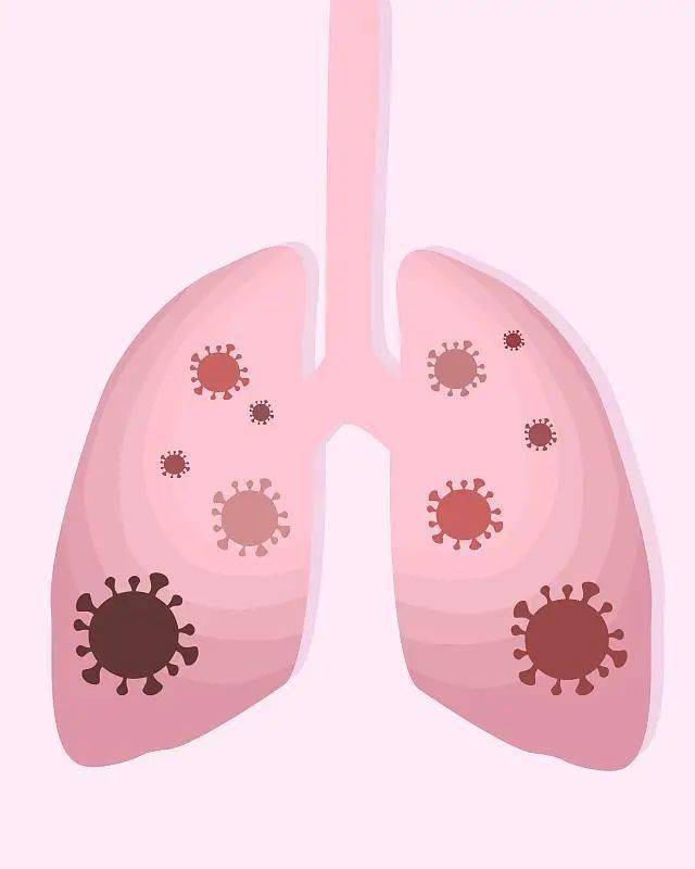 肺白是怎么回事_白肺症状_肺白是什么病