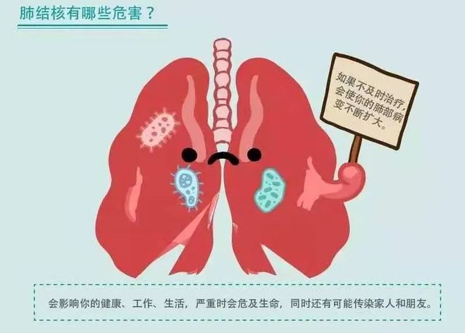 空洞型肺结核严重吗-探索空洞型肺结核：医学进步与现实挑战的交汇