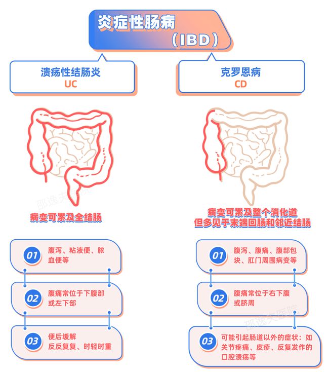 克罗恩氏病症状-克罗恩氏病患者的治疗与生活挣扎：痛苦与希望并存