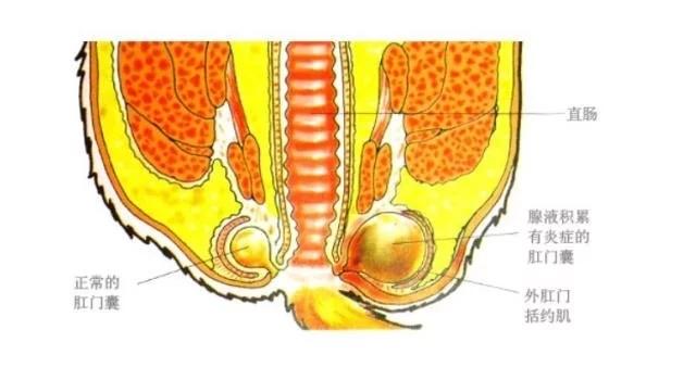 肛门坠胀大便后加重_大便肛门坠胀痛_肛门坠胀大便失禁