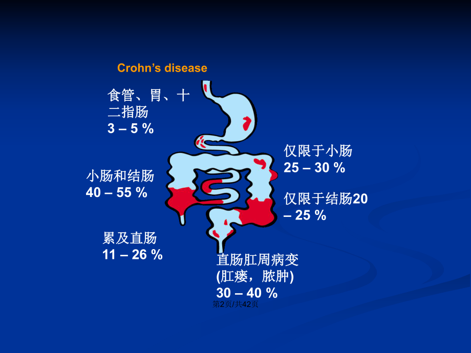 罗克恩病能治好吗_罗克罗恩病_克罗恩病吃什么食物好