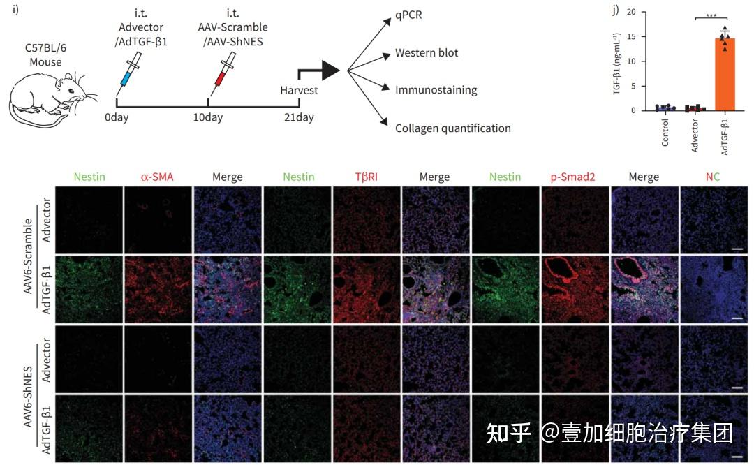 克隆抗体是什么_克隆抗体检测是什么意思_呼吸道合胞病毒单克隆抗体