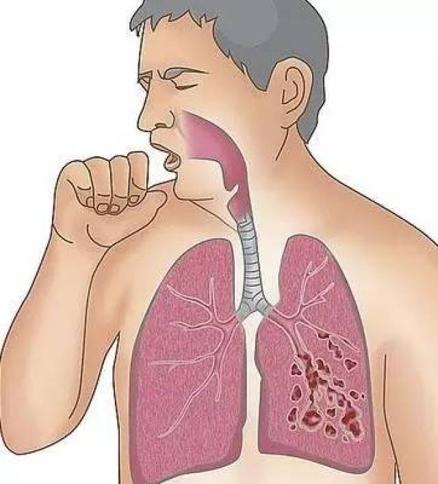 为什么会突然哮喘_哮喘突然犯了会不会死_哮喘突然加重