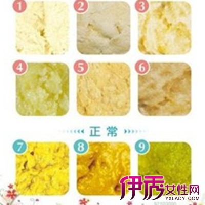 出血大便疼回事是什么原因_出血大便疼回事是怎么回事_大便出血是怎么回事 不疼