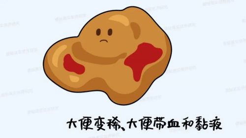 出血大便疼回事是什么原因_大便出血是怎么回事 不疼_出血大便疼回事是怎么回事