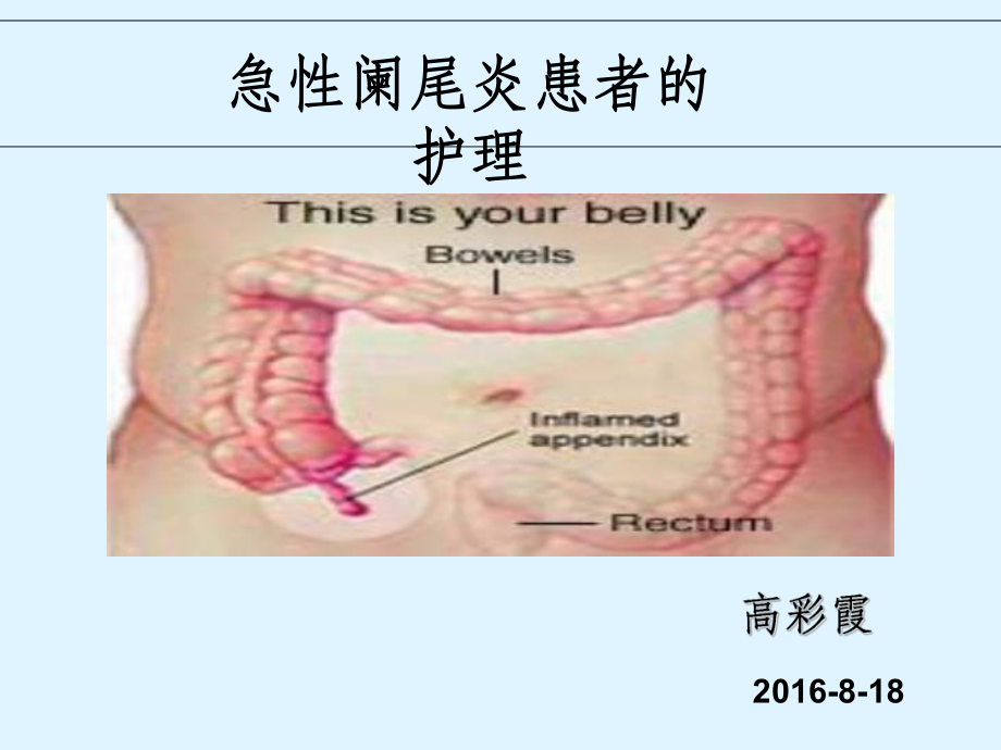 急性化脓性阑尾炎术后护理_急性化脓性阑尾炎术后护理_急性化脓性阑尾炎术后护理