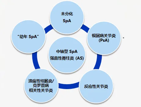 克罗恩病关节炎治疗_克罗恩关节炎症指什么_克罗恩病关节炎