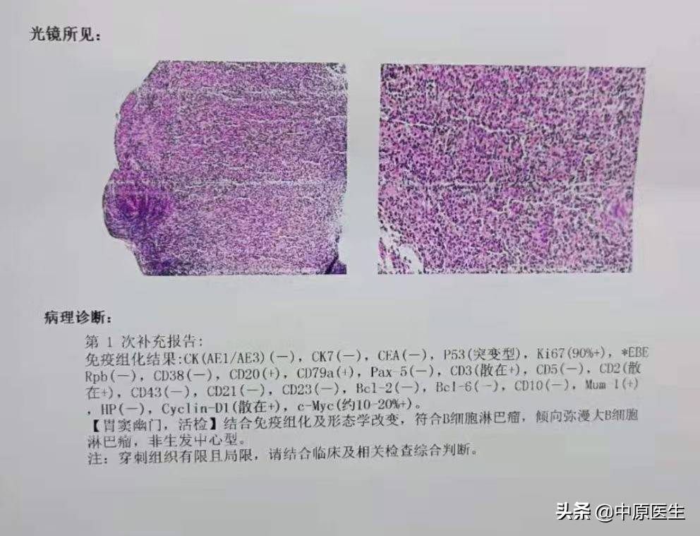 中医治疗胃溃疡_胃中医治疗溃疡的方剂_胃中医治疗溃疡的方子