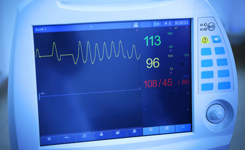 心电监护的目的-心电监护：倾听生命的脉搏，与时间赛跑，与死神抗争