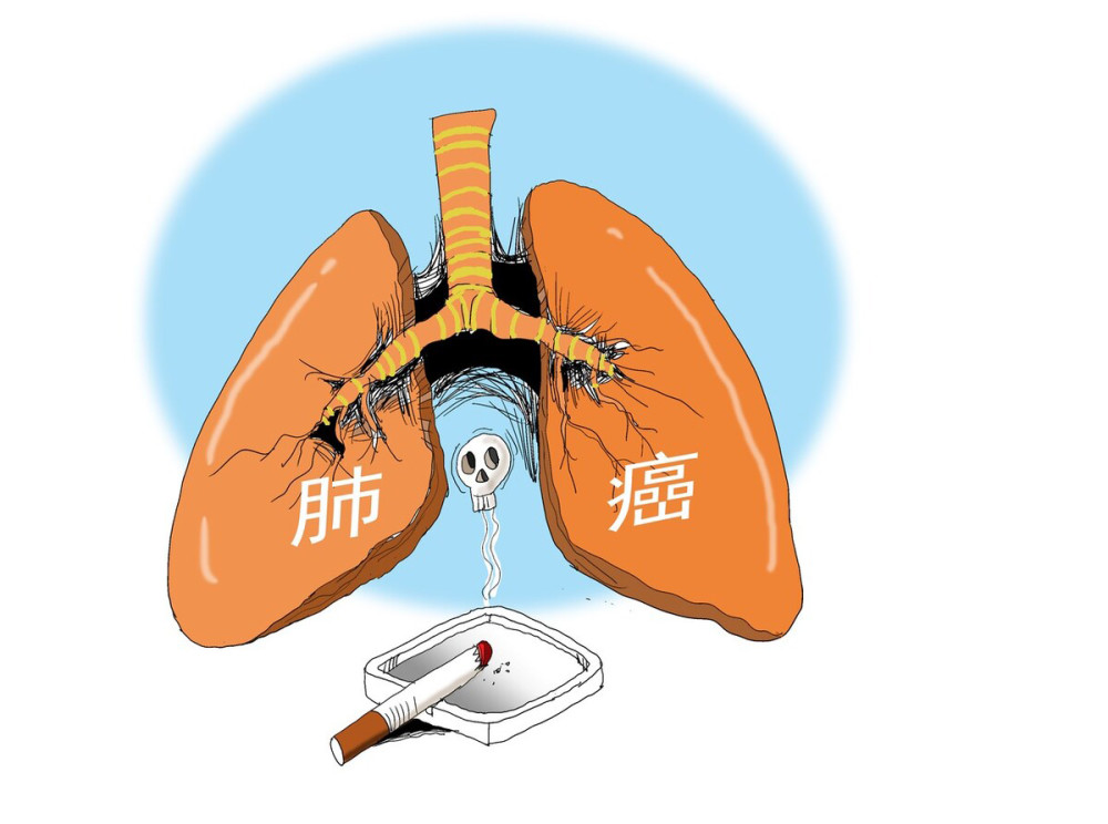 肺癌白蛋白低会有什么危险_肺癌白蛋白_白蛋白肺癌