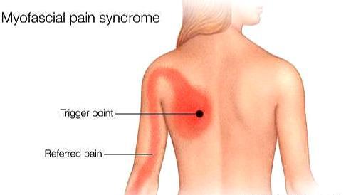 后背疼痛引起前胸痛_前胸后背疼痛八种病因_后背疼前胸也疼是怎么回事
