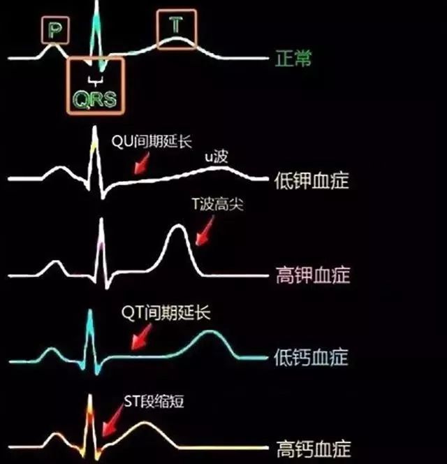 血压冠心病区别高压低压_血压冠心病区别高还是低_高血压和冠心病的区别