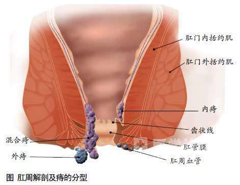 肛门擦不干净_肛门擦干净一会又有屎有啥方法_肛门擦不干净