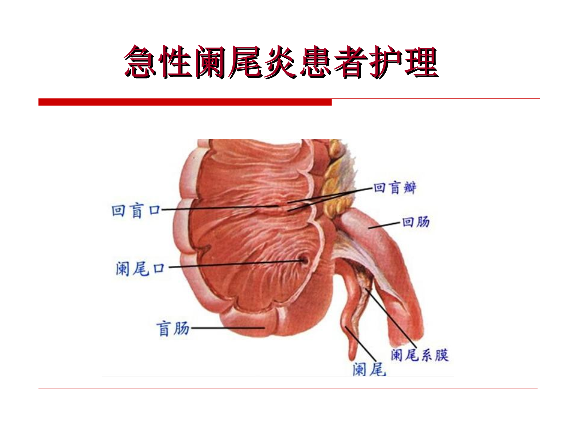 急性阑尾炎术后护理常规ppt_急性阑尾炎术后护理课件_简述急性阑尾炎术后护理