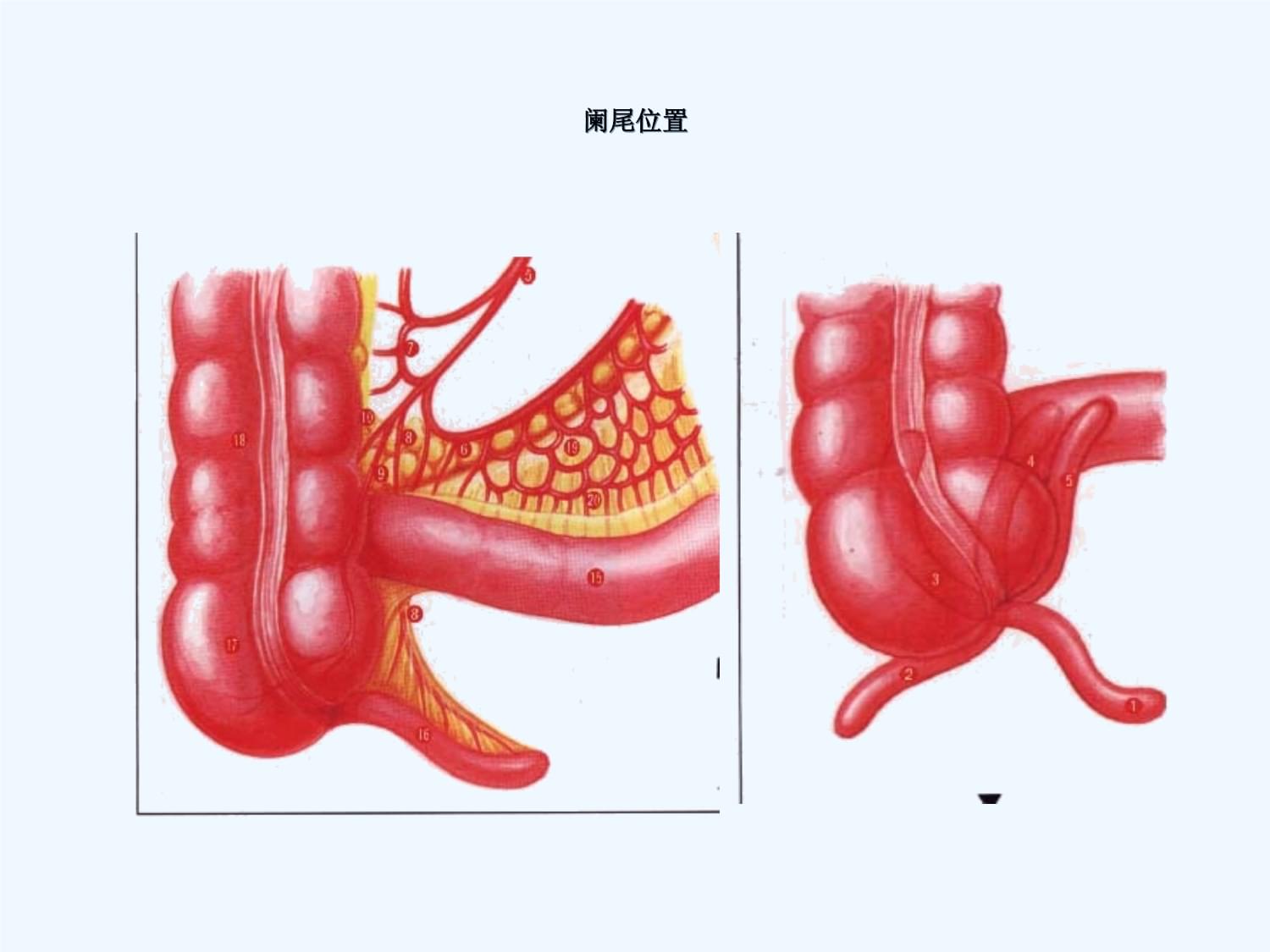 简述急性阑尾炎术后护理_急性阑尾炎术后护理课件_急性阑尾炎术后护理常规ppt