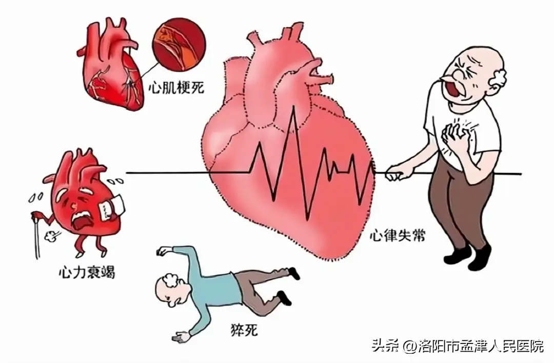 冠心病的治疗方法有哪些_冠心病 治疗_冠心病治愈大概多少钱