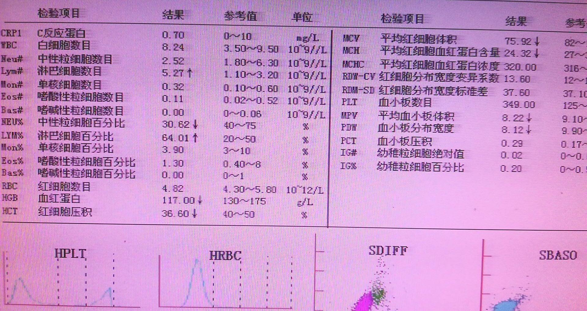 急性化脓性阑尾炎术后护理_急性化脓性阑尾炎术后护理_急性化脓性阑尾炎术后护理